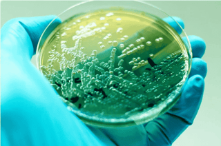 Pseudomonas aeruginosa positive results